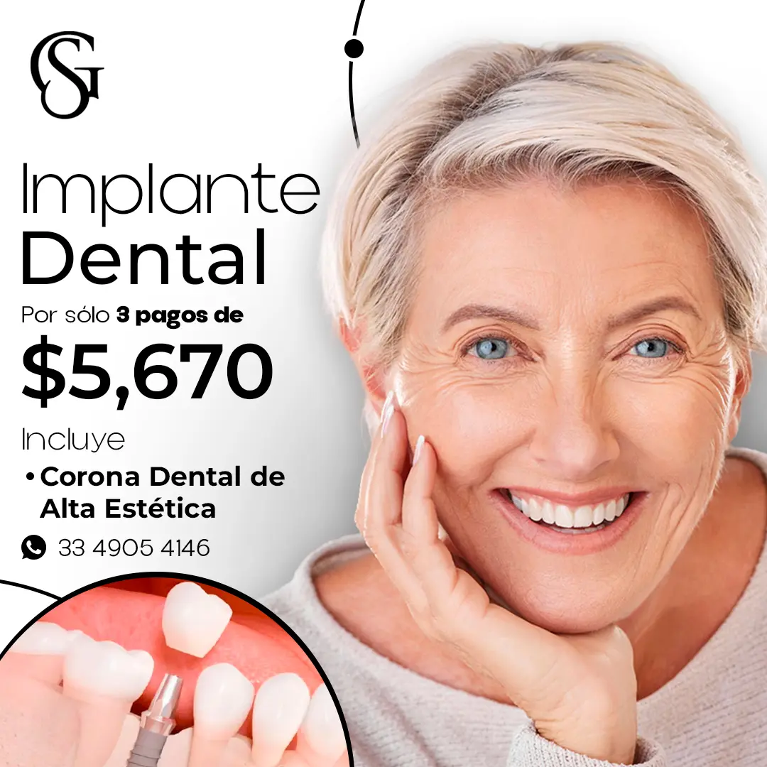 Implante Dental en 3 Pagos