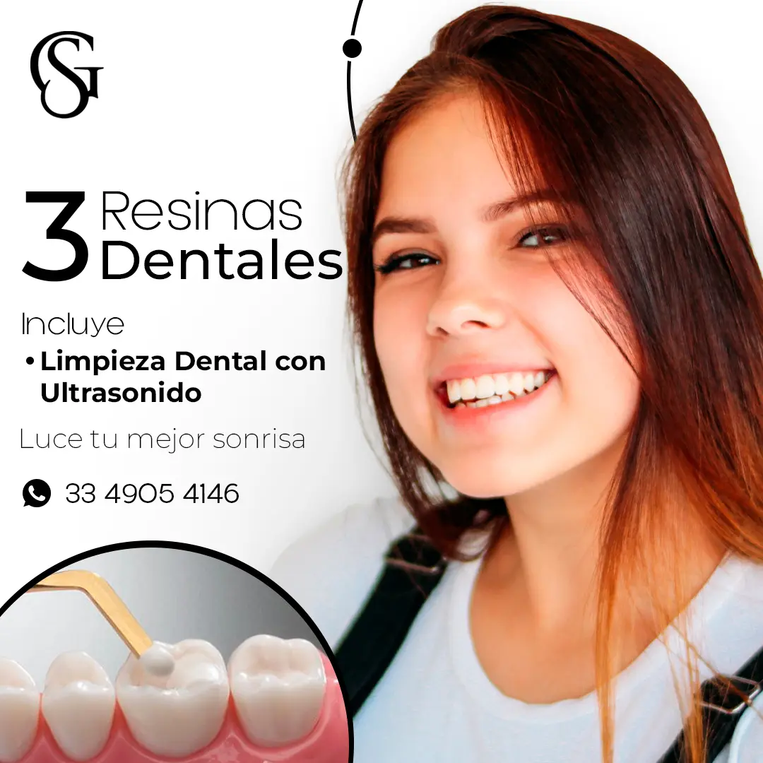 3 Resinas Dentales + Limpieza Gratis